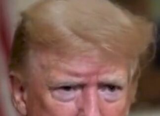 WTH Happened To Trump’s Face? Did He Try To Saw Off the Top Of His Head? Hello, Frankenstein