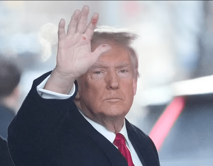 Trump cut hand