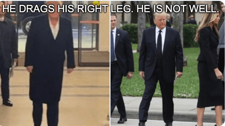 Trump drags leg