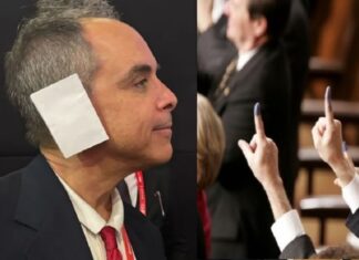 GOP Dilemna – Ear ‘Diaper’ Or ‘Bloody Ear’ Version Of Iraqi Purple Fingers?