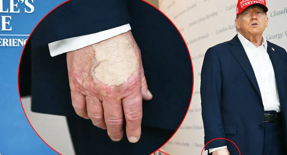 Trump's hand makeup