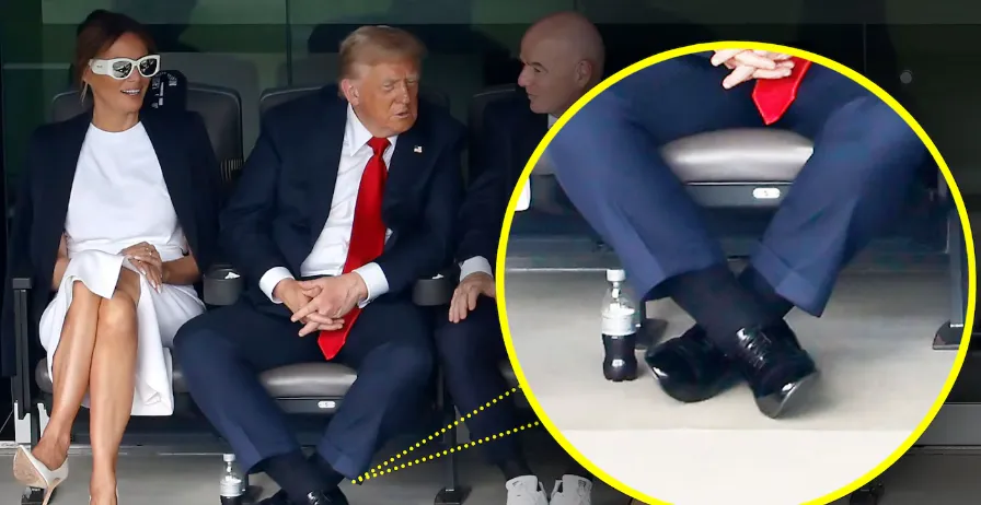 Trump cankles