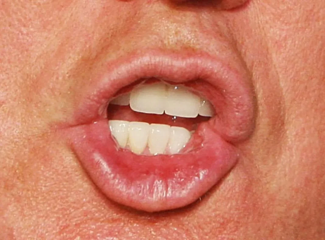 Trump Loose Lips A 03-18-2026